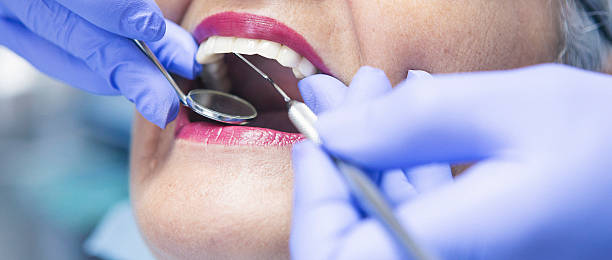 Best Emergency Dental Care for Broken or Chipped Teeth in Privateer, SC